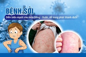 Thủ tướng y&#234;u cầu tăng cường c&#244;ng t&#225;c ph&#242;ng, chống bệnh Sởi