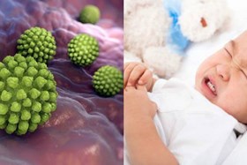 Dấu hiệu v&#224; triệu chứng của virus Rota